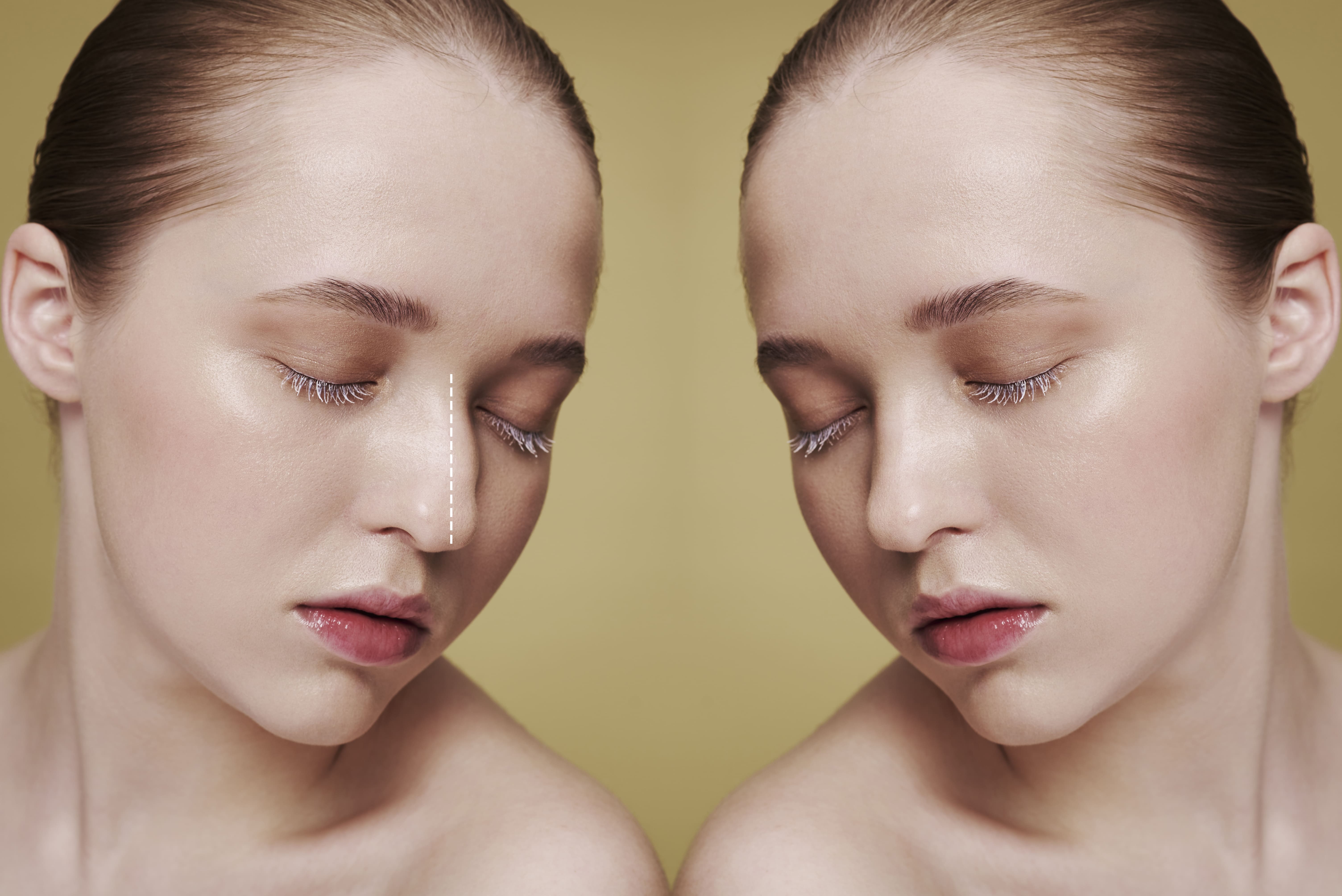 Treatment before and after