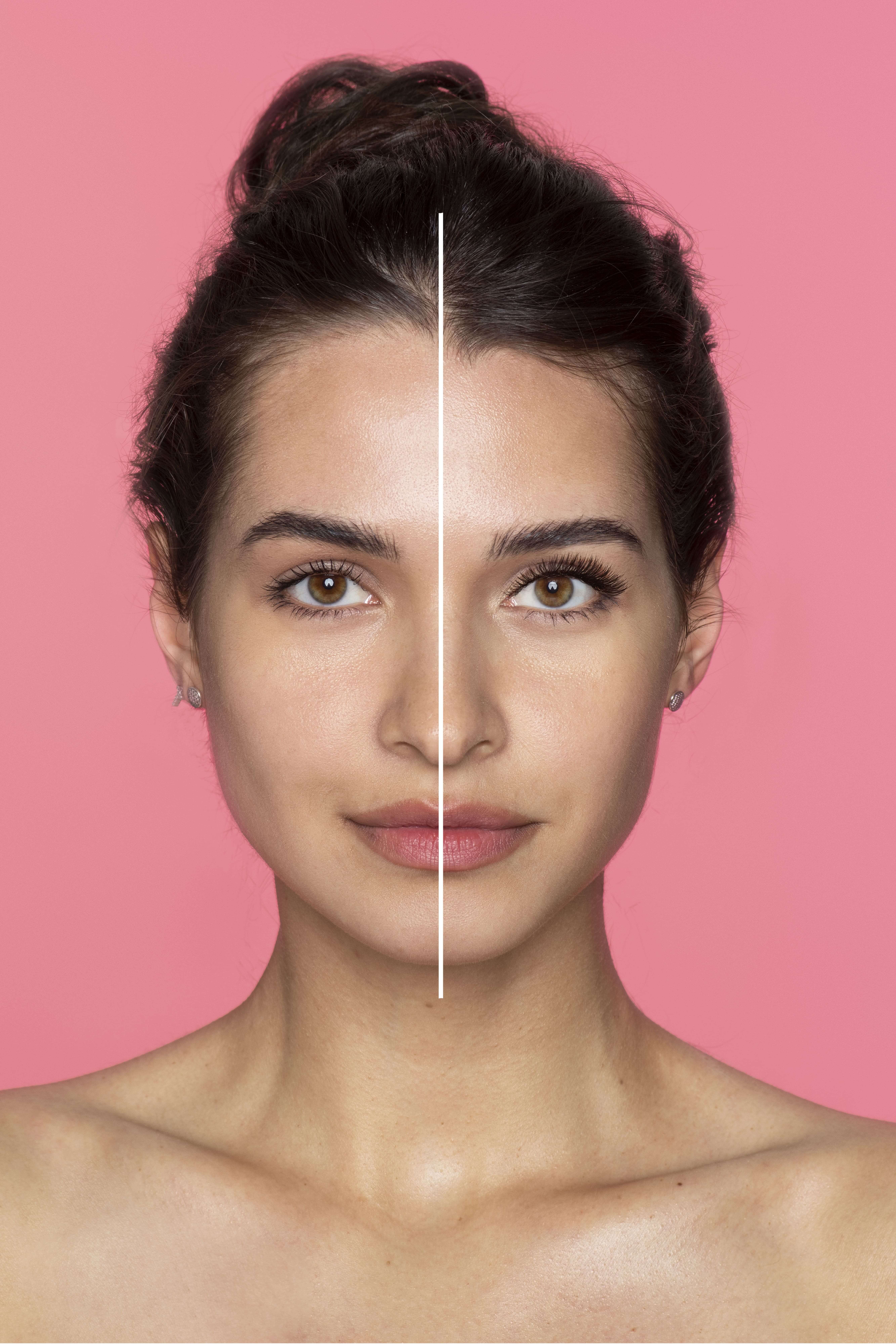 Treatment before and after