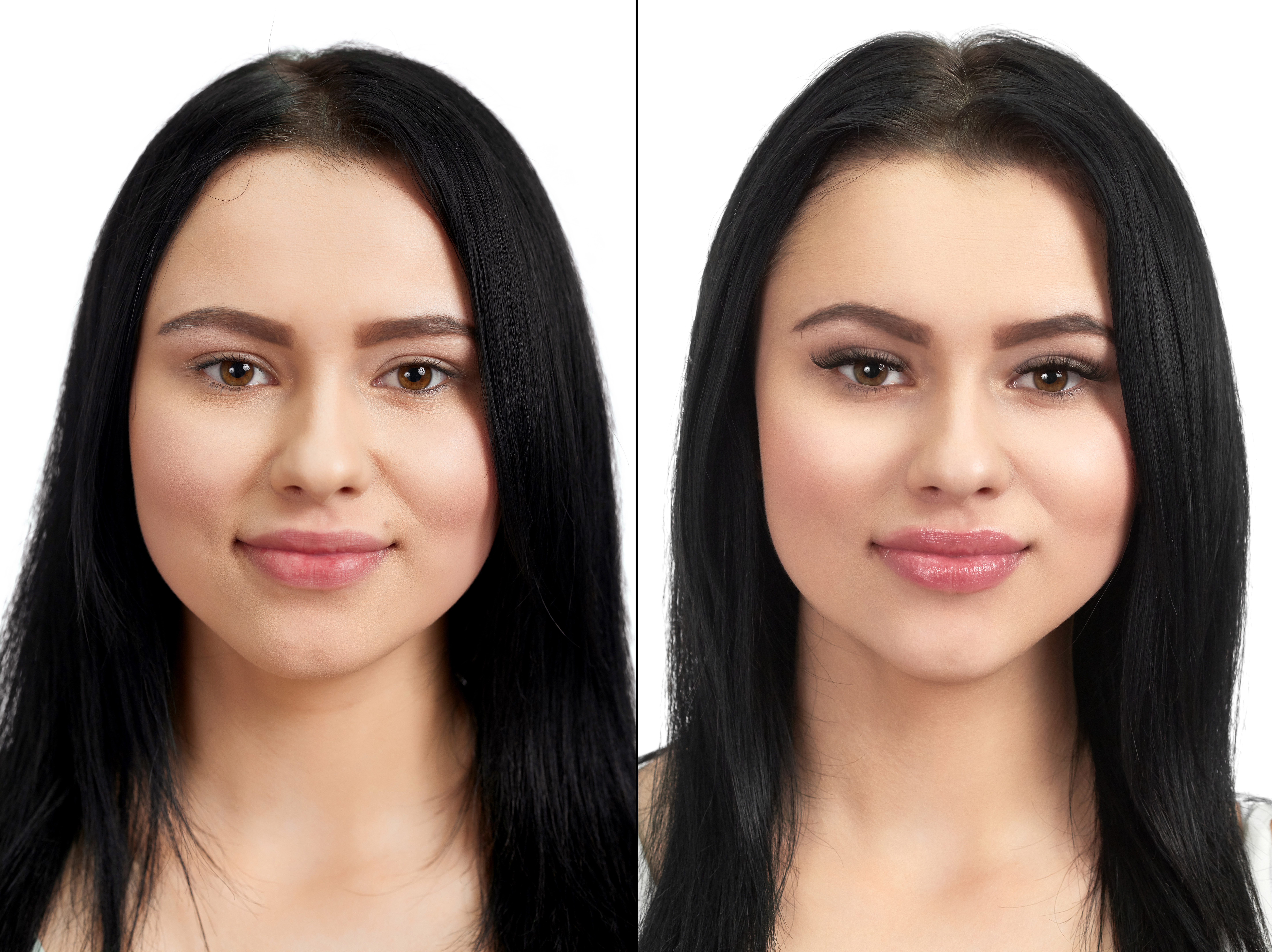 Treatment before and after